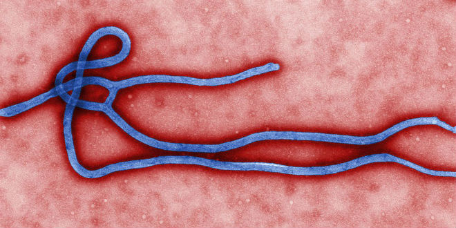 Ebola virus. Photo: WikiCommons